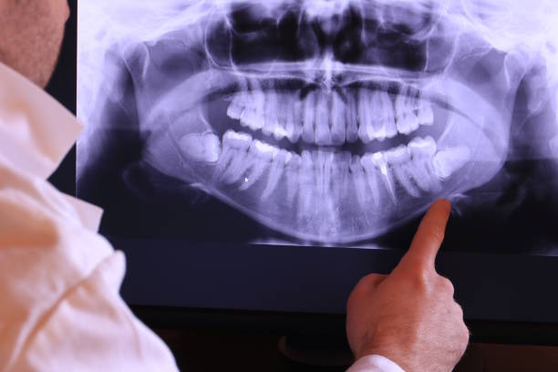 Best Emergency Care for Gum Disease in Burkburnett, TX