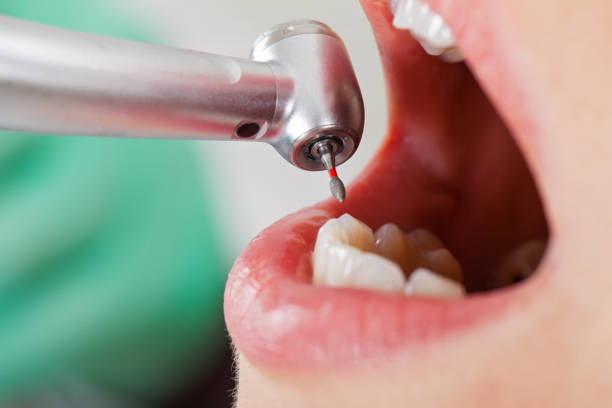 Best Emergency Pediatric Dental Care in Burkburnett, TX